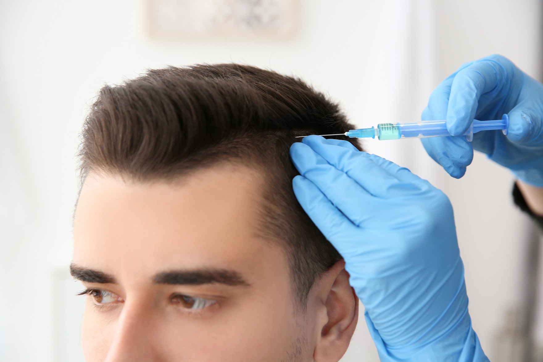 GFC and PRP Hair treatment in bhopal